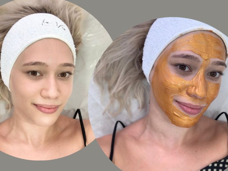 Você sabe o que é detox facial? Conheça o procedimento que hidrata e revitaliza a pele
